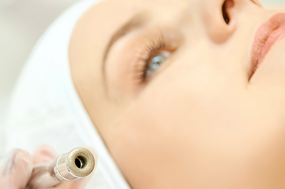Ganzgesichtige Botox-Behandlung